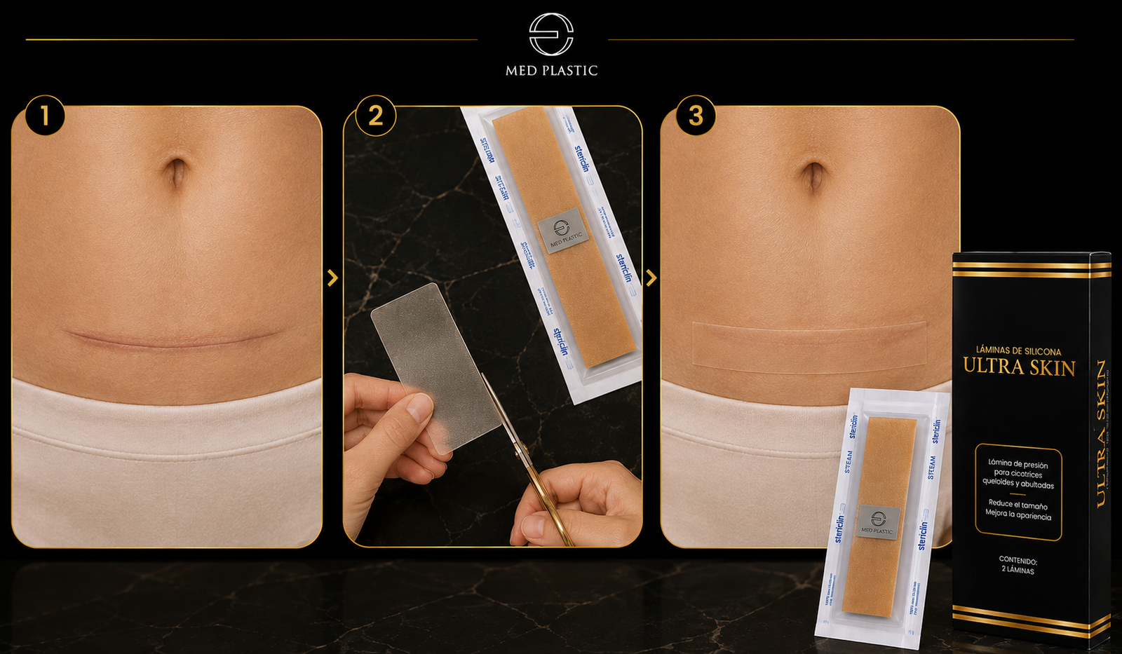 Cómo usar UltraSkin en una cicatriz de cesárea cerrada