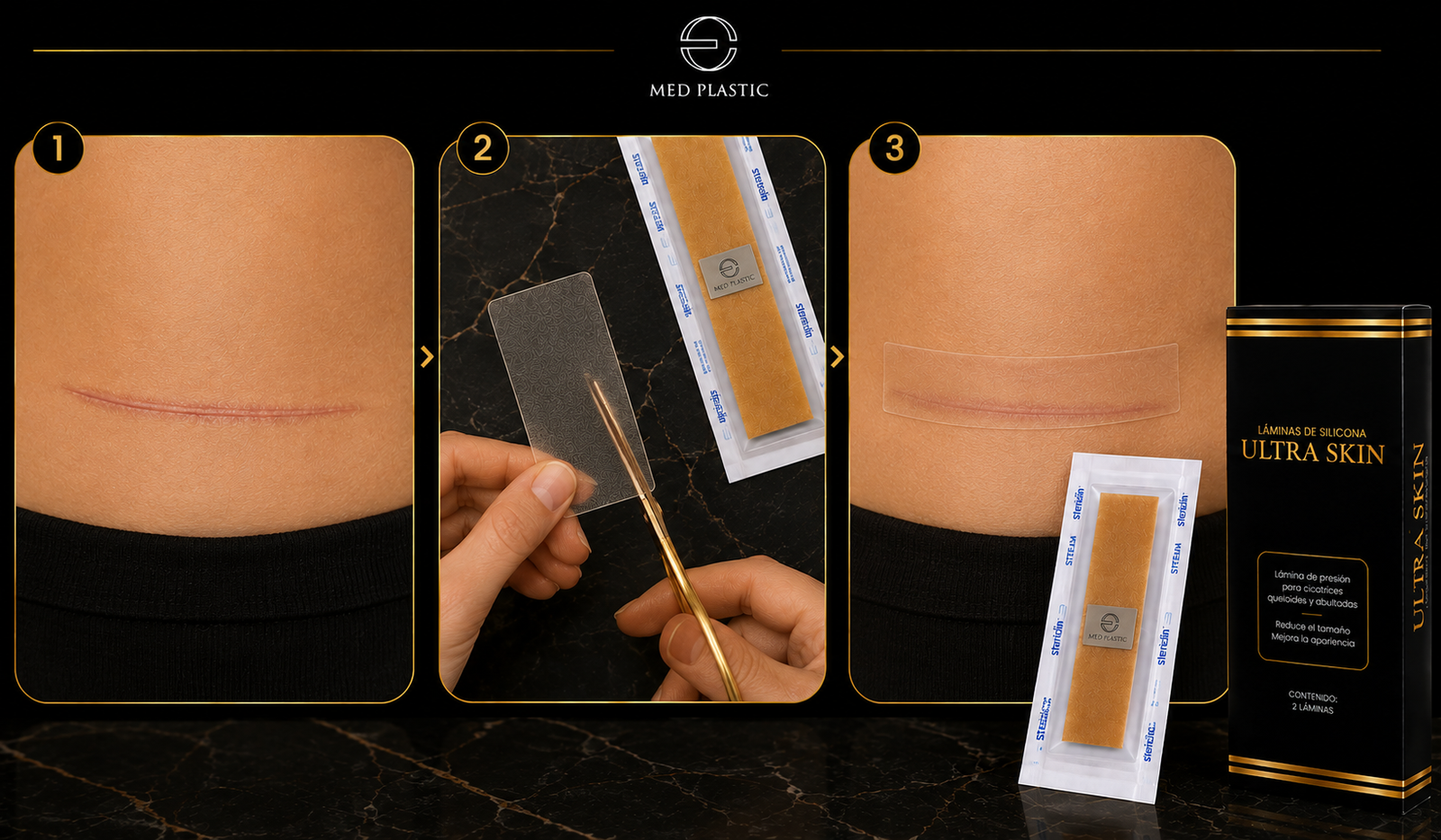 Cómo usar UltraSkin en una cicatriz postoperatoria cerrada