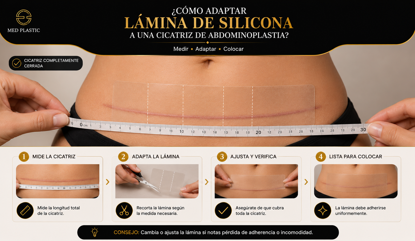 Cómo adaptar una lámina de silicona a una cicatriz de abdominoplastia