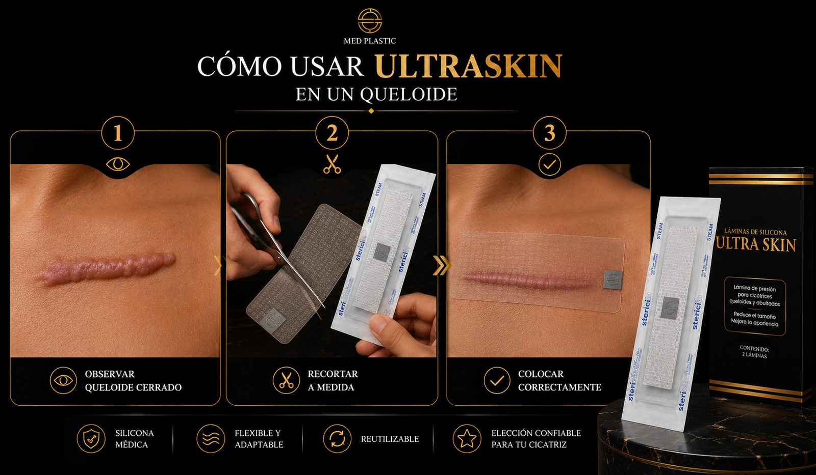 Cómo usar UltraSkin en un queloide completamente cerrado
