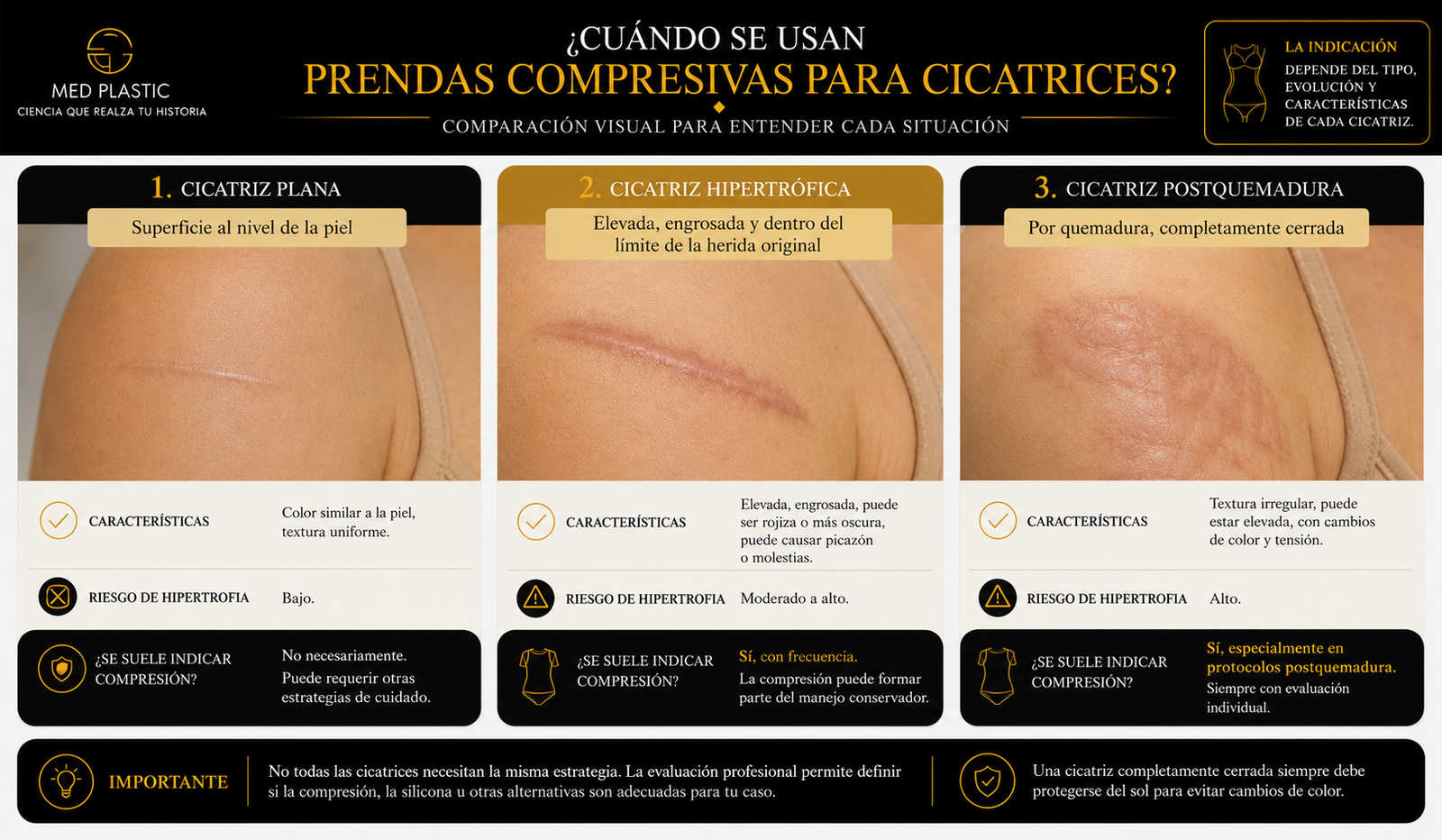 Cuándo se usan prendas compresivas para cicatrices