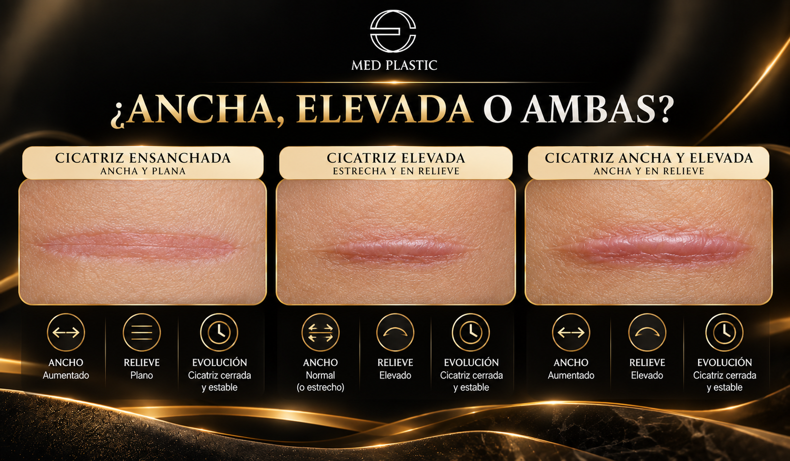 Diferencia entre cicatriz ensanchada, elevada y cicatriz ancha con relieve