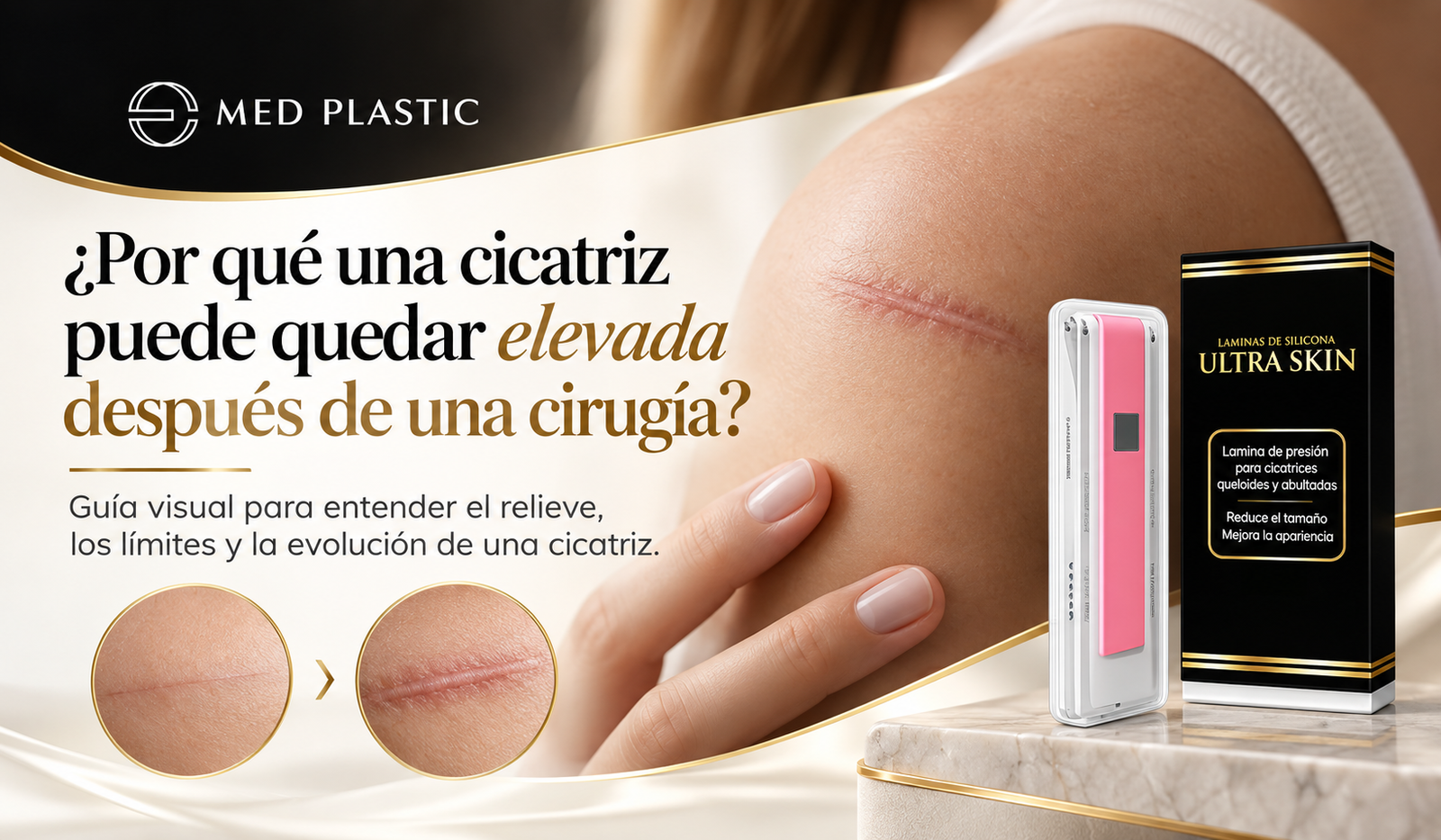 ¿Por qué una cicatriz puede quedar elevada después de una cirugía?
