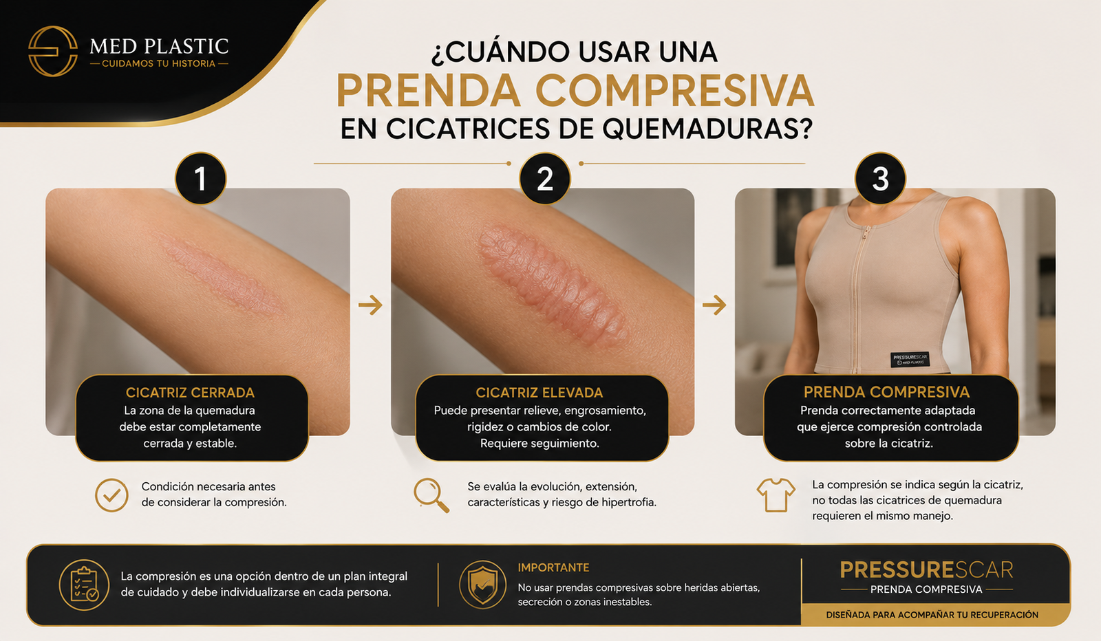 Cuándo usar una prenda compresiva en cicatrices de quemaduras