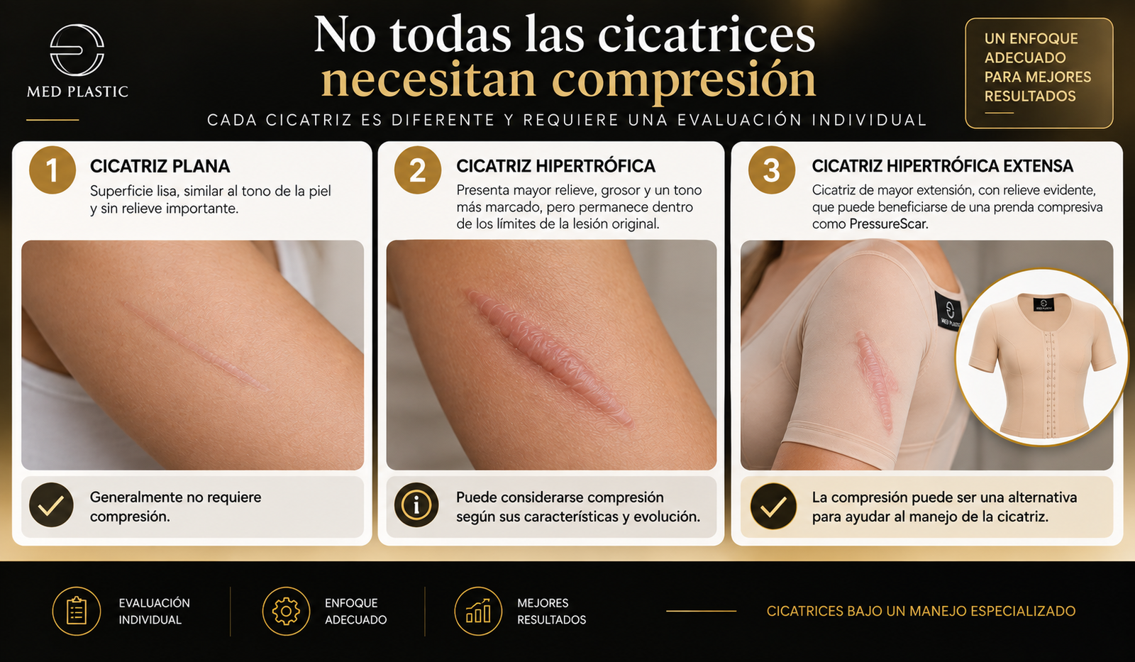 Cuándo considerar compresión para cicatriz hipertrófica