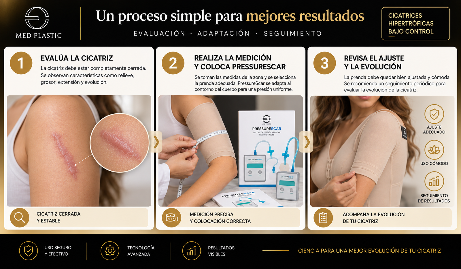 Cómo usar PressureScar en cicatriz hipertrófica cerrada