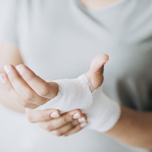 Woman with gauze bandage wrapped around her hand